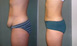 meilleur chirurgien esthétique 93700,drancy chirurgien esthétique 93700 drancy