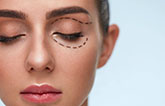 avis blépharoplastie tunisie