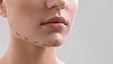 augmentation mammaire avis 33270 floirac