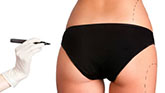 meilleure clinique esthétique pour des implants seins 33270 floirac