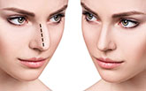chirurgie correction nez tunisie